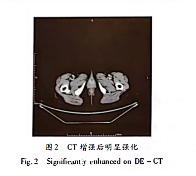 wuwei