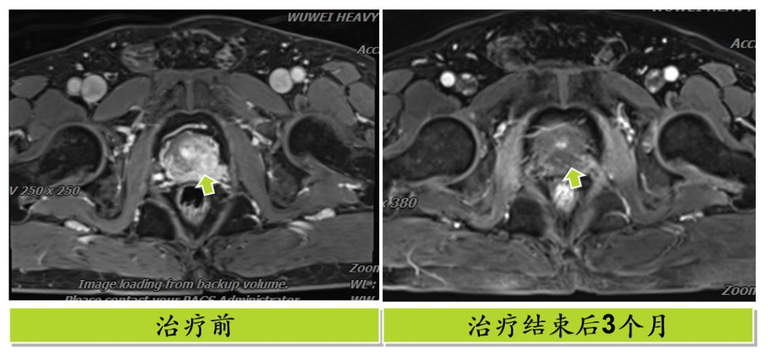 wuwei