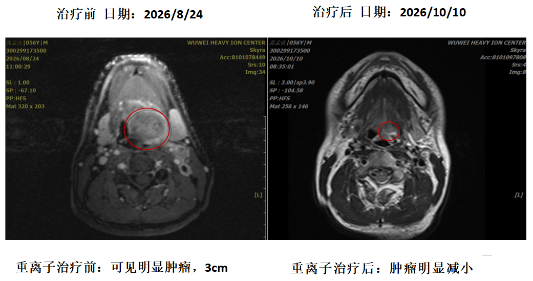 wuwei