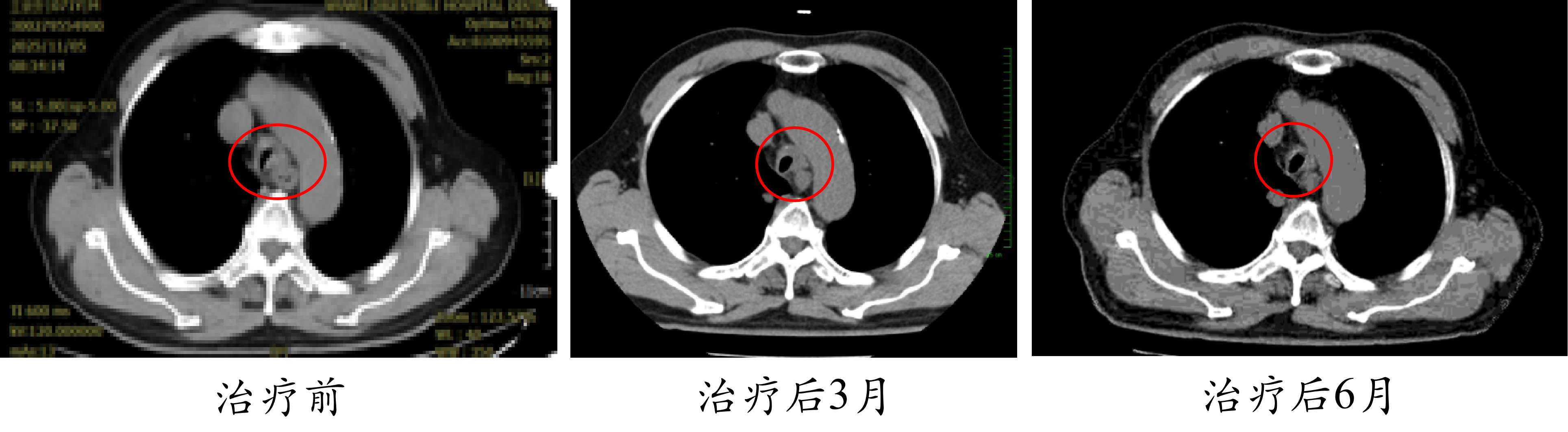 wuwei