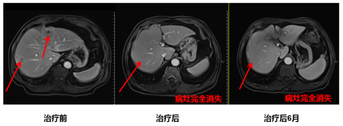 wuwei