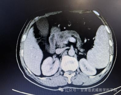 wuwei