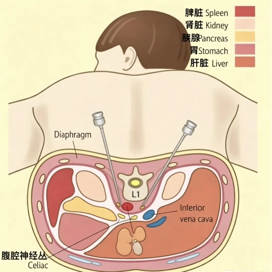 wuwei