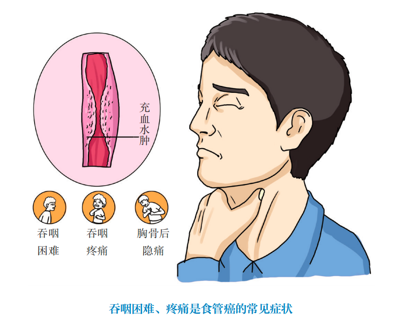 wuwei