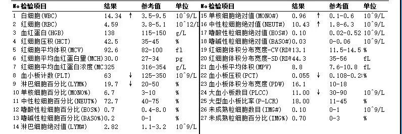 wuwei