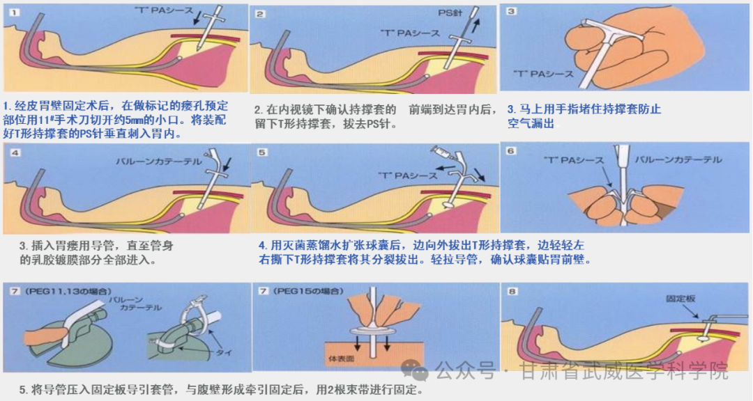wuwei