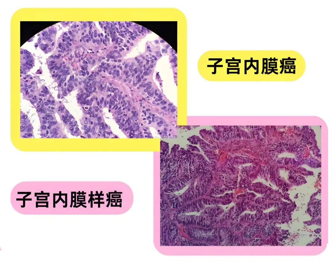 wuwei