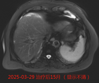 wuwei