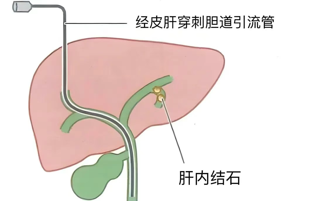 wuwei